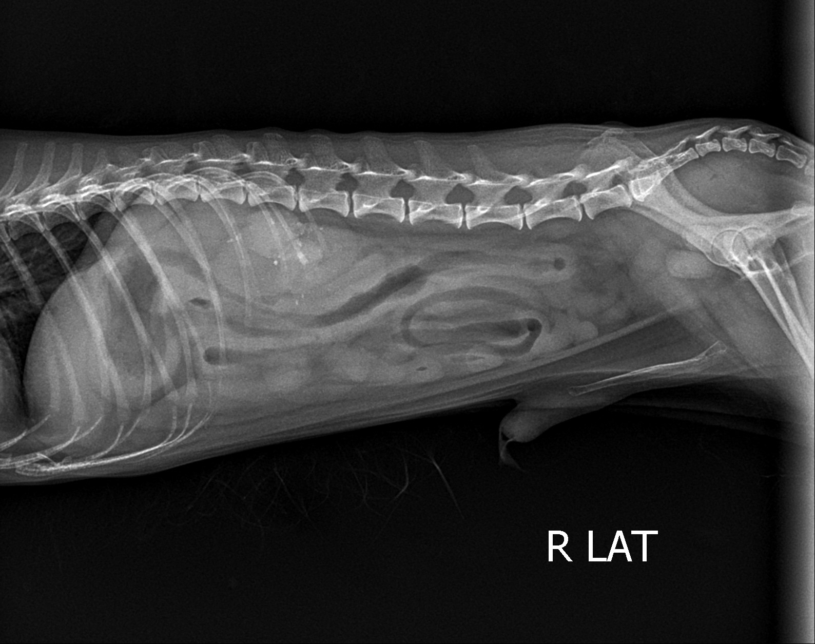 レントゲン画像