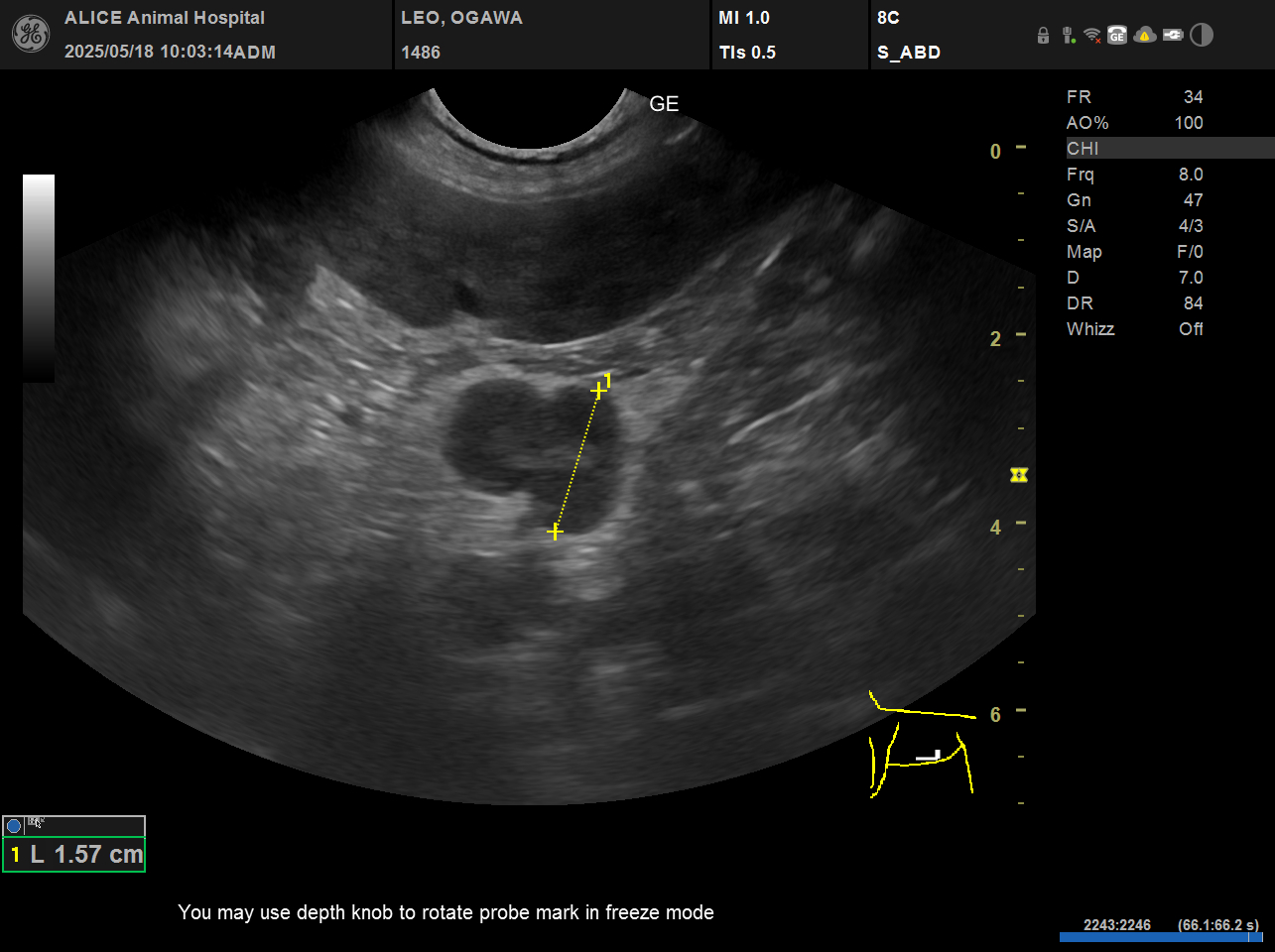 超音波（エコー）検査の画像