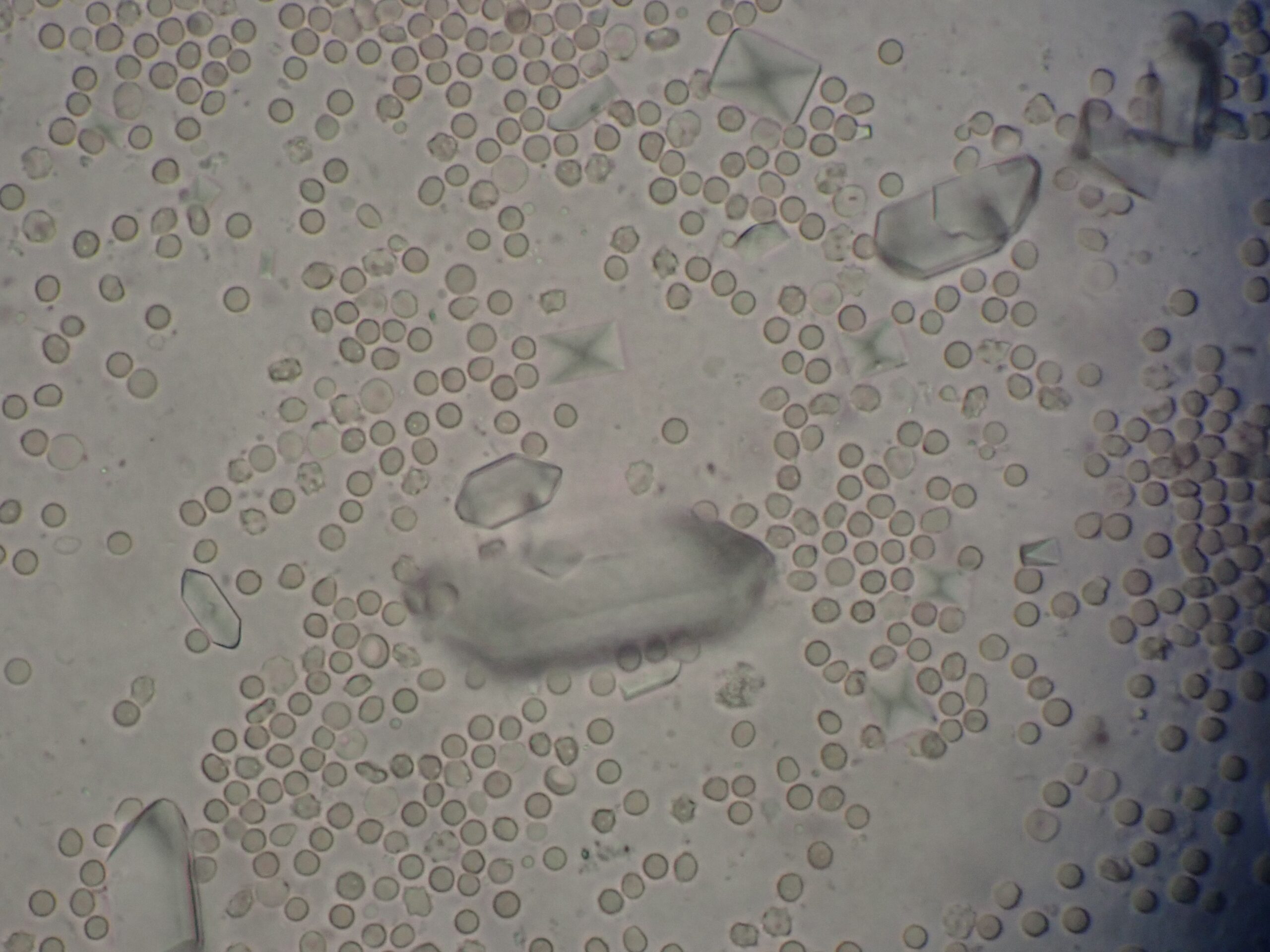 尿検査：ストラバイト結晶の顕微鏡像