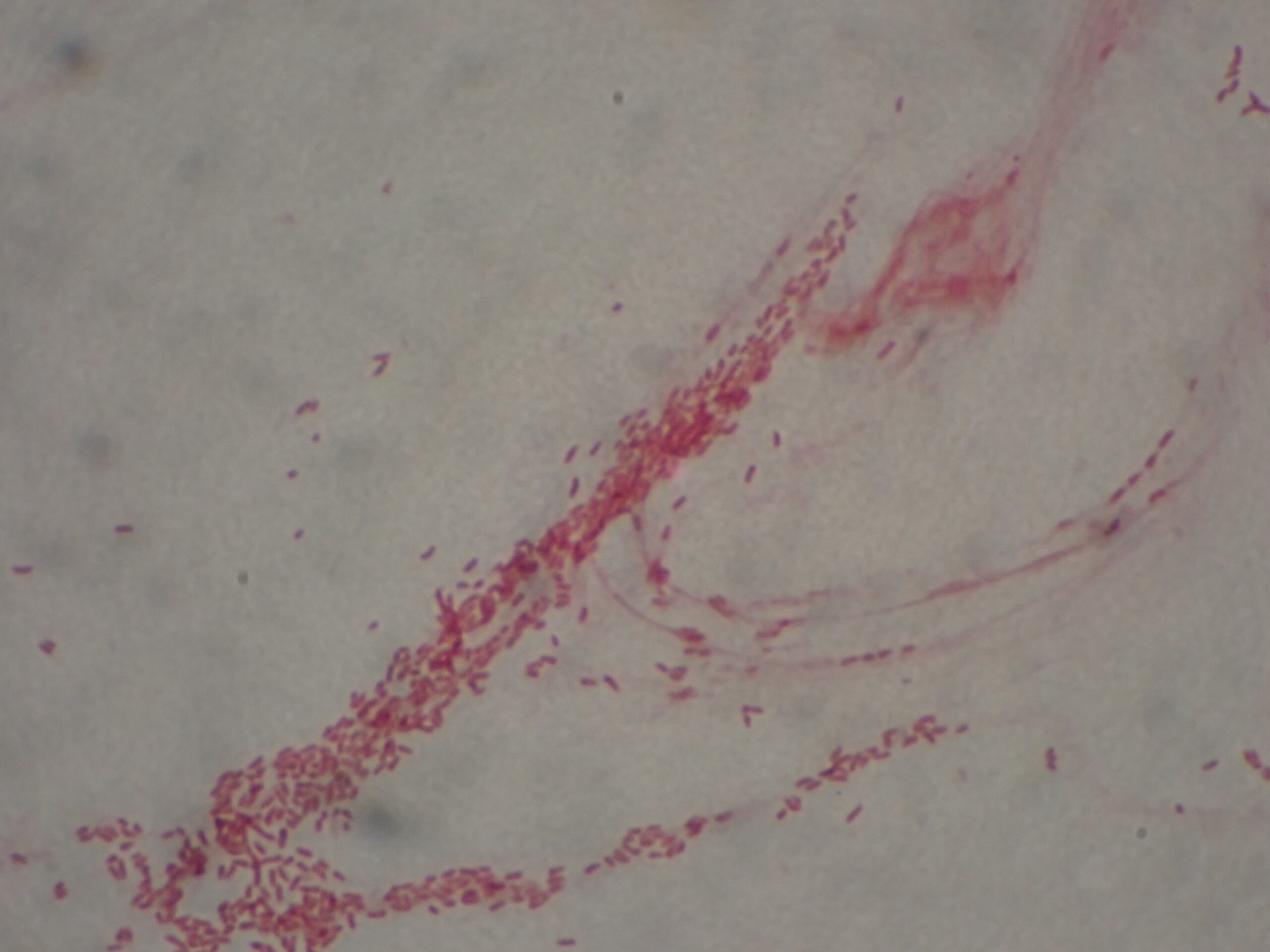 グラム染色画像